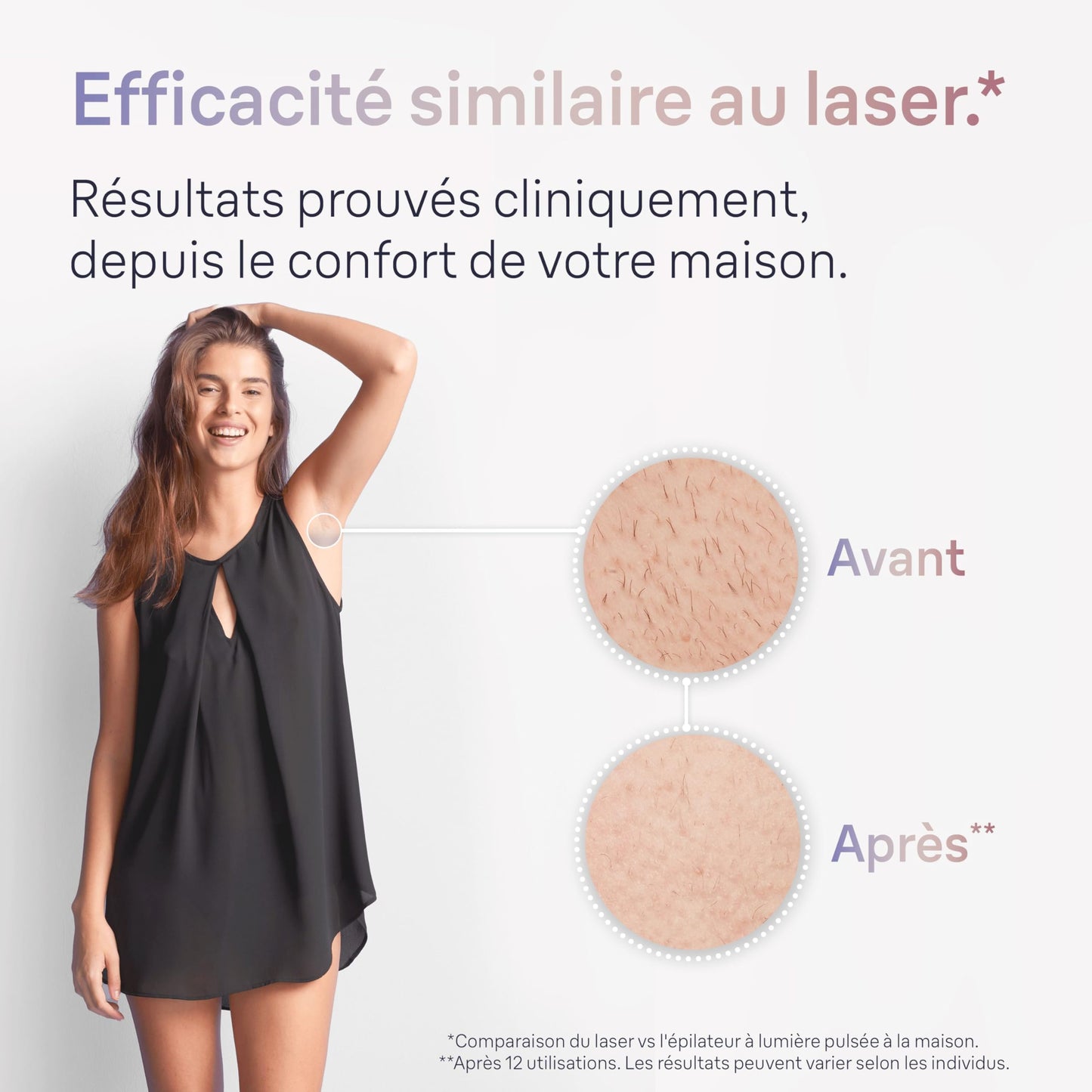 Braun Skin i·expert, Épilateur À Lumière Pulsée Intelligent, Épilation À Domicile, Alternative Au Laser, Avec Application, Vanity, Rasoir Venus, 4 Têtes Intelligentes, 1,5 an De Peau Douce, PL7387